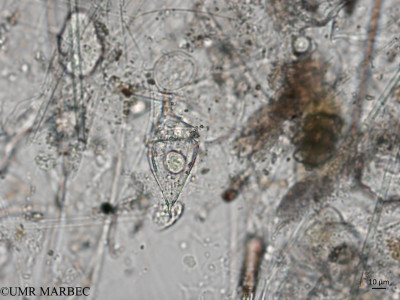 phyto/Brazilian_Nordeste/AtoldasRocas_station22/ABRACOS1 October 2015/Oxytoxum milneri (Snap-2197)(copy)_thumb.jpg